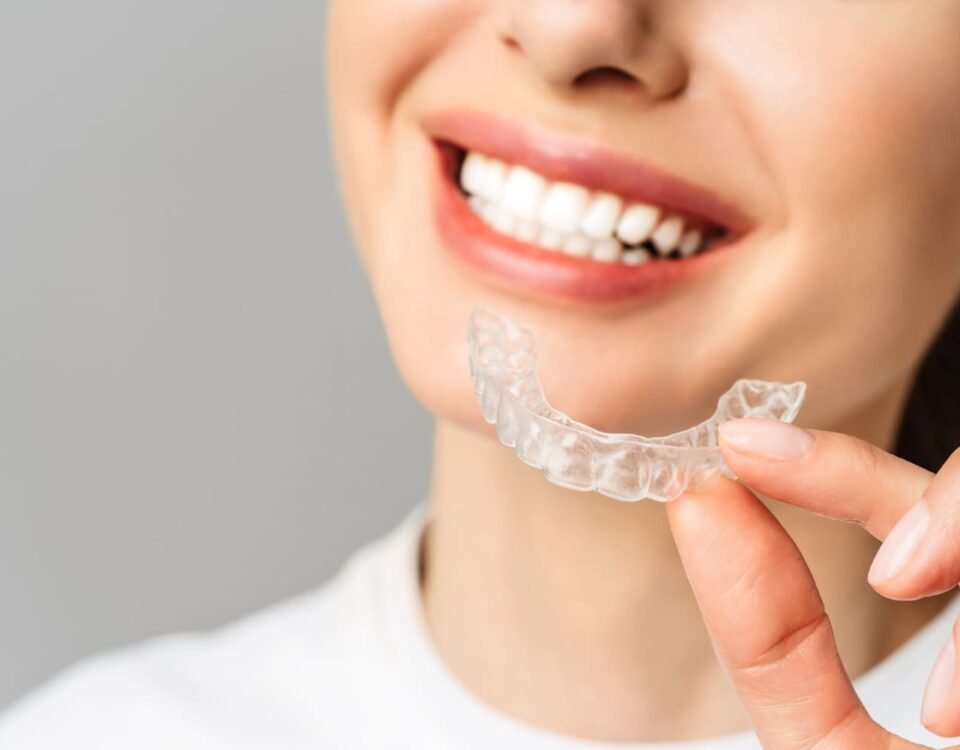 bite e serramento dentale